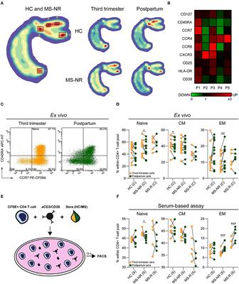 Effector T Helper Cells Are Selectively Controlled During Pregnancy and Related to a Postpartum Relapse in Multiple Sclerosis